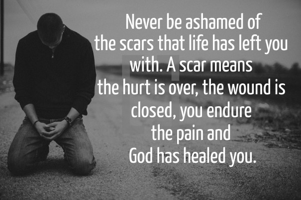 Never be ashamed of the scars that Design 